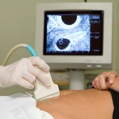 Sonographer Career Analysis